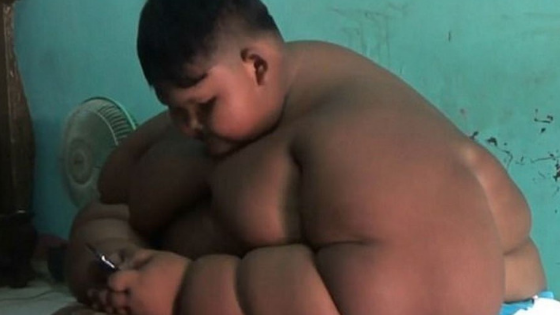 Menino de dez anos atinge 190 quilos