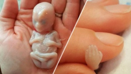 Mãe publica fotos de seu bebê depois de aborto e causa revolta