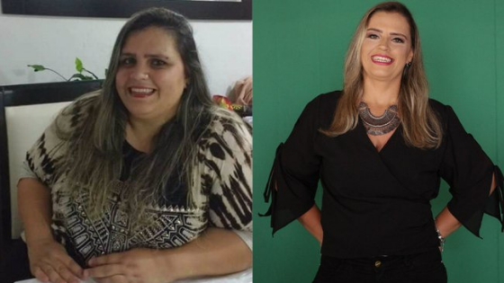 Mulher perde 80 kg em 8 meses